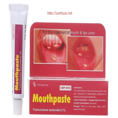 Mouthpaste 5g - Thuốc điều trị viêm loét miệng hiệu quả
