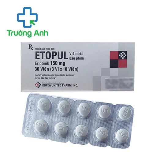 Etopul 150mg Korea United Pharm - Thuốc điều trị ung thư phổi hiệu quả