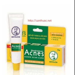 Acnes  - Kem trị sẹo hiệu quả của Nhật Bản